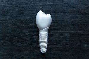 Zirconia dental implants in India