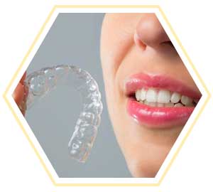 clear path aligners in chennai